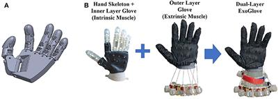 Wearable Robotic Glove Design Using Surface-Mounted Actuators